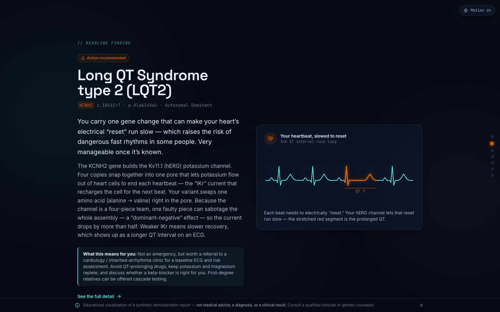 Headline finding with animated ECG